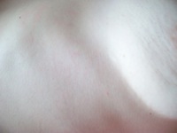 100_0571